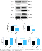 https://www.tobaccoinduceddiseases.org/f/fulltexts/218816/TID-24-74-g004_min.jpg