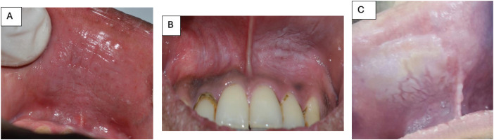 https://www.tobaccoinduceddiseases.org/f/fulltexts/224437/TID-24-141-g002_min.jpg