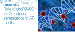 Figure from article: Cigarette smoke-induced...