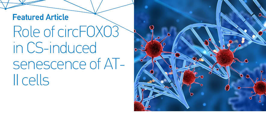 Figure from article: Cigarette smoke-induced...