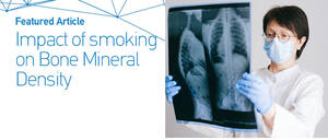 Figure from article: Smoking shapes the...